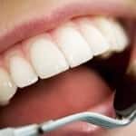 Teeth. Credit: Istockphoto Teeth. Credit: Istockphoto