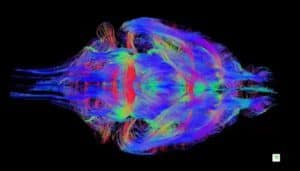 Mapping the vast networks of the brain; 10,000 million neurons, each with 10,000 connections. Credit: Queensland Brain Institute