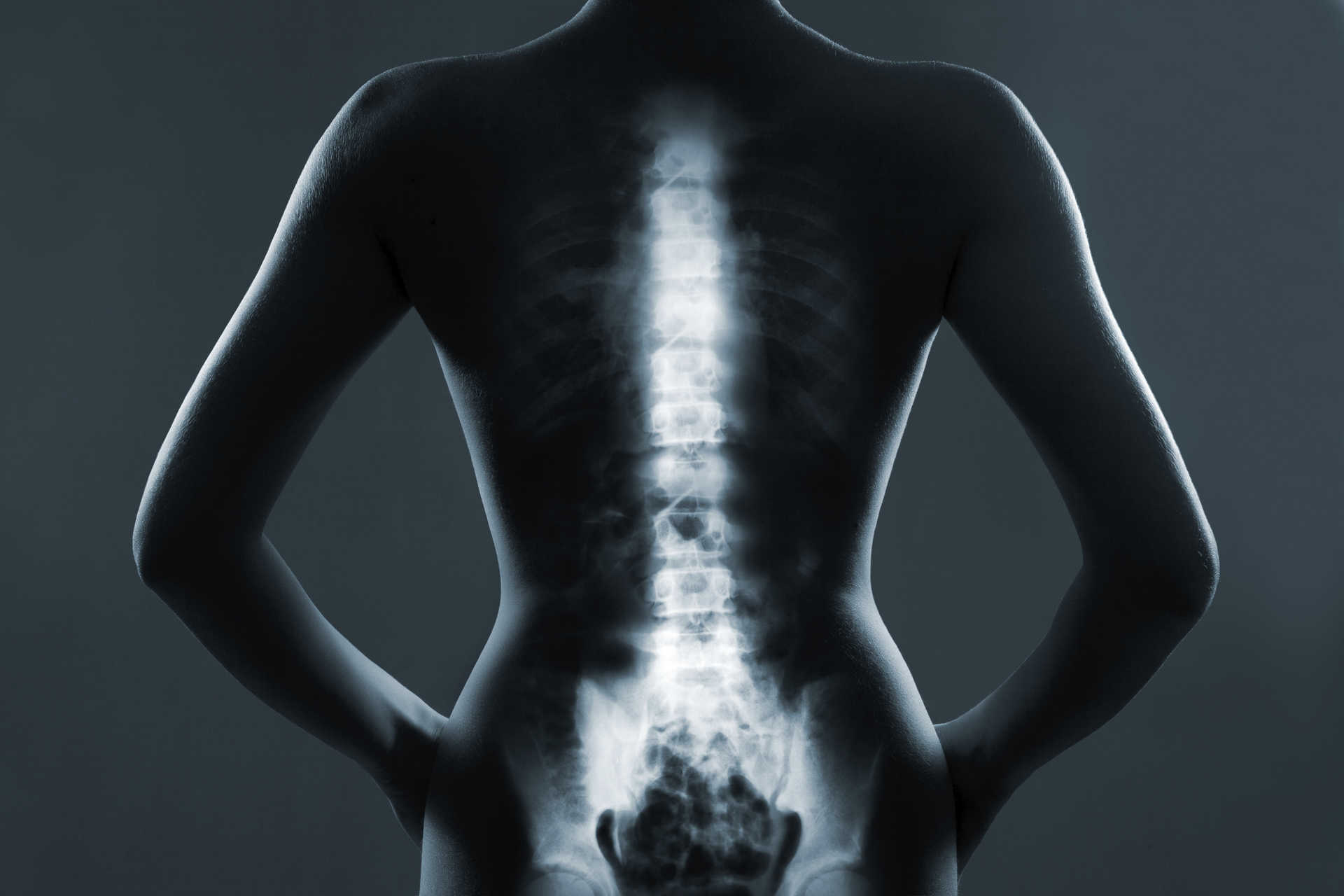 Head to tail: the molecules that tell you how to grow a backbone ...